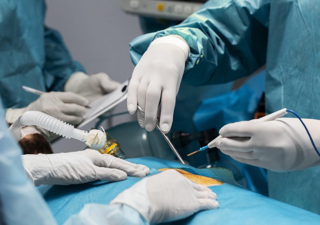 Vascular surgery